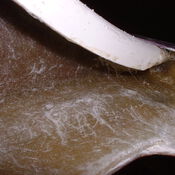 Renovatie NED268 370